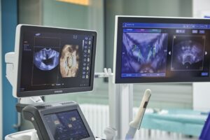 Ultraschall Urologie